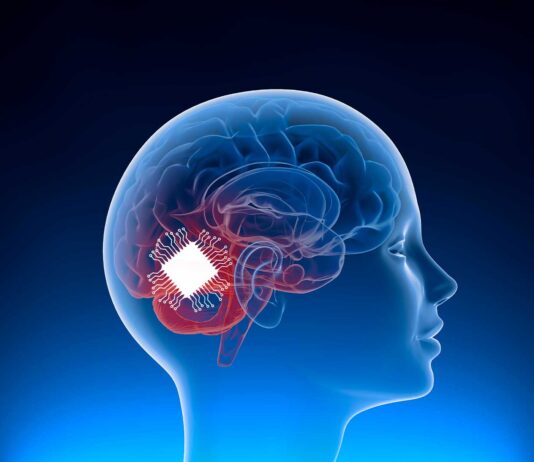 Implantes cerebrales | La próxima frontera en la interfaz hombre-máquina implantes cerebrales